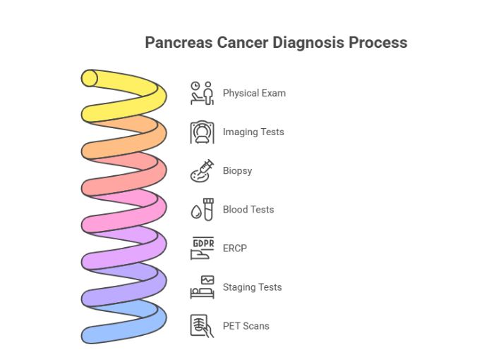 Diagnosis of Pancreas Cancer